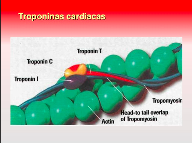 Demasiadas troponinas: los peligros de «perseguir analíticas»